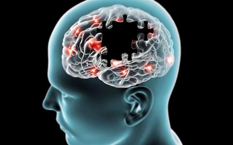 Les effets du CBD - Les bienfaits du CBD sur le cerveau - Saveurs-CBD